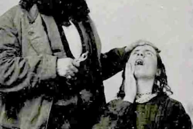 Dentiste en 1850