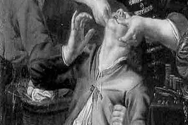 Le travail du chirurgien barbier au 17 siecle