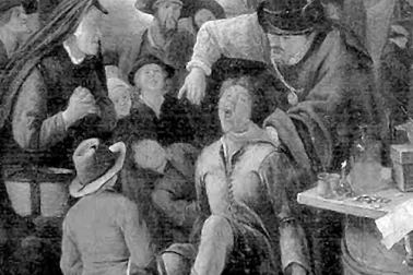 Chirurgien barbier - Dentistes au 17 siecle