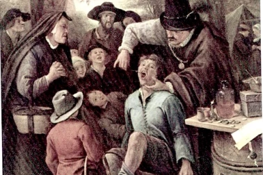 Chirurgien barbier - Dentistes au 17 siecle